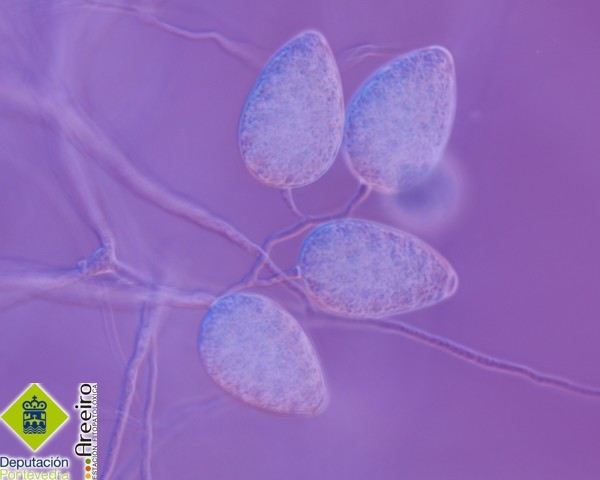 Phytophthora pseudosyringae >> Esporangios en simpodios caracteristicos de P pseudosyringae.jpg